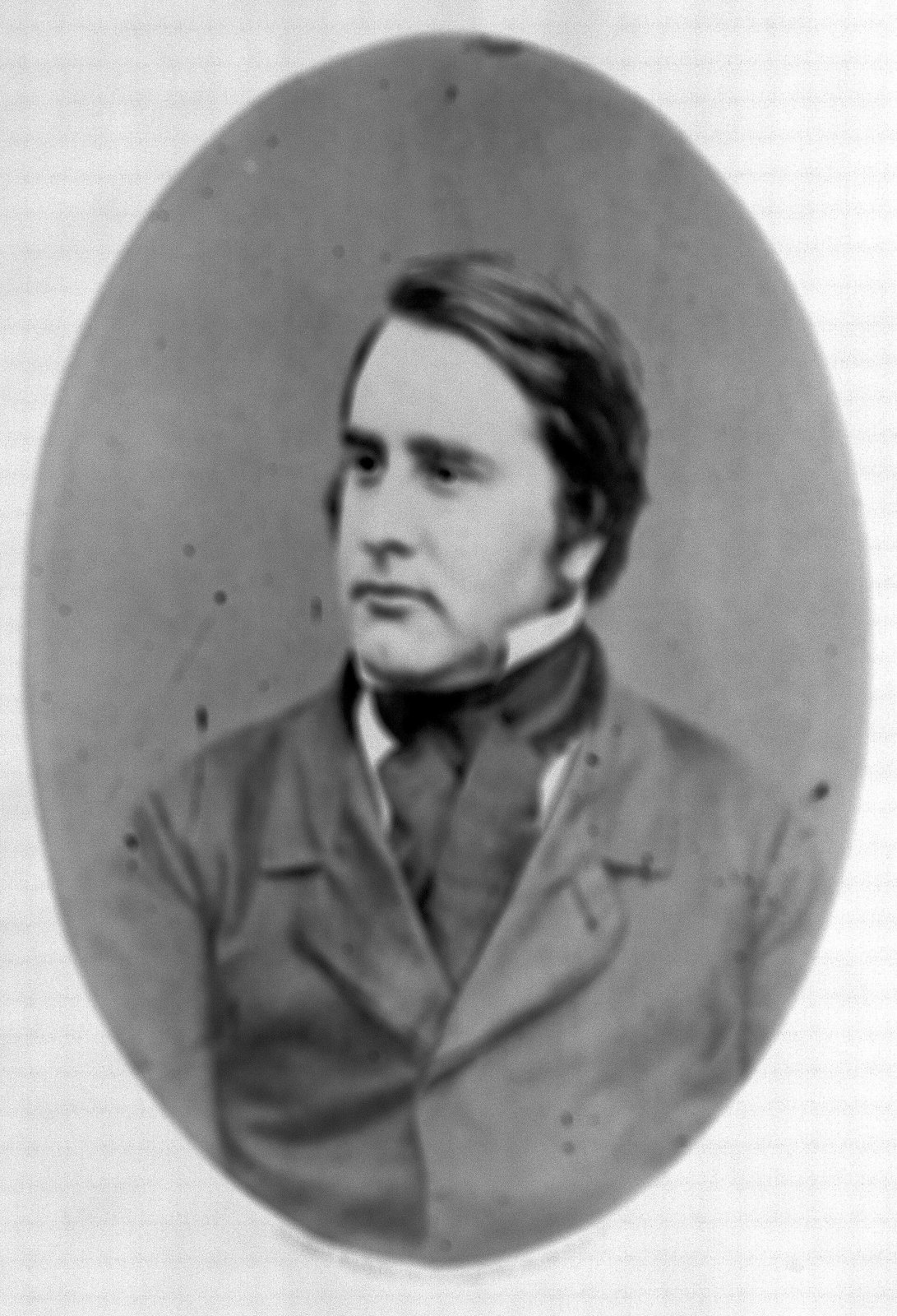 윌리엄 걸의 사진입니다. 1873년 어른에게 생기는 이 병을 처음으로 학회에 보고한 의사입니다 (사진: Herbert Watkins, Wellcome Collection, CC BY 4.0, 위키미디어 공용)